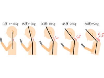 スマートフォン症候群　首の角度