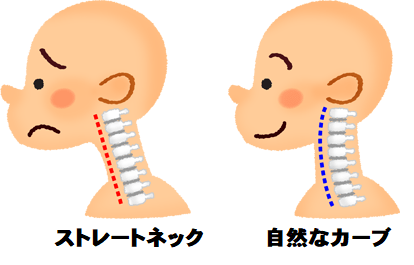 ストレートネック