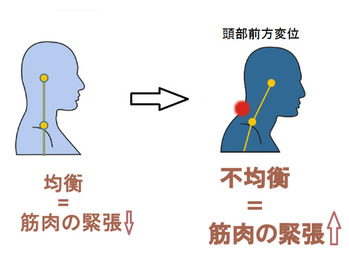 猫背　肩こり　原因