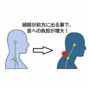 首への負担イメージ