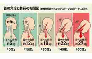 首への負担画像